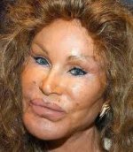 BOTOX.jpg